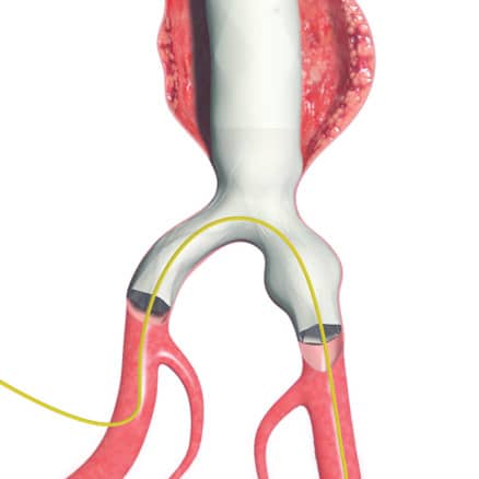 AFX2 unibody anatomy illustration